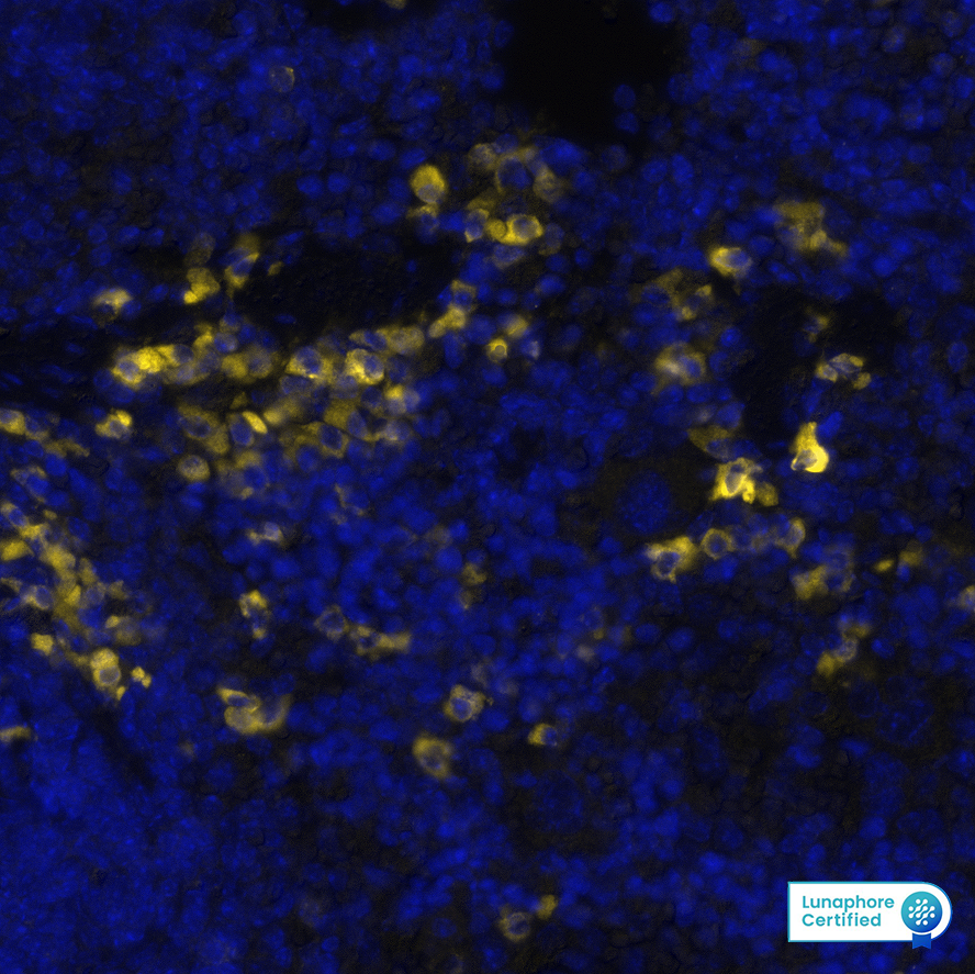 CD11c was detected in immersion fixed paraffin-embedded sections of mouse Spleen using Mouse anti-CD11c, Monoclonal Antibody (Catalog #NBP2-34491) at 1:200 dilution at 37 ° Celsius for 4 minutes. Before incubation with the primary antibody, tissue underwent an all-in-one dewaxing and antigen retrieval preprocessing using PreTreatment Module (PT Module) and Dewax and HIER Buffer H (pH 9; Epredia Catalog # TA-999-DHBH). Tissue was stained using the Alexa Fluor™ 647 Goat anti-Mouse IgG Secondary Antibody at 1:200 at 37 ° Celsius for 2 minutes. (Yellow; Lunaphore Catalog # DR647MS) and counterstained with DAPI (blue; Lunaphore Catalog # DR100). Specific staining was localized to the cytoplasm. Protocol available in COMET™ Panel Builder.