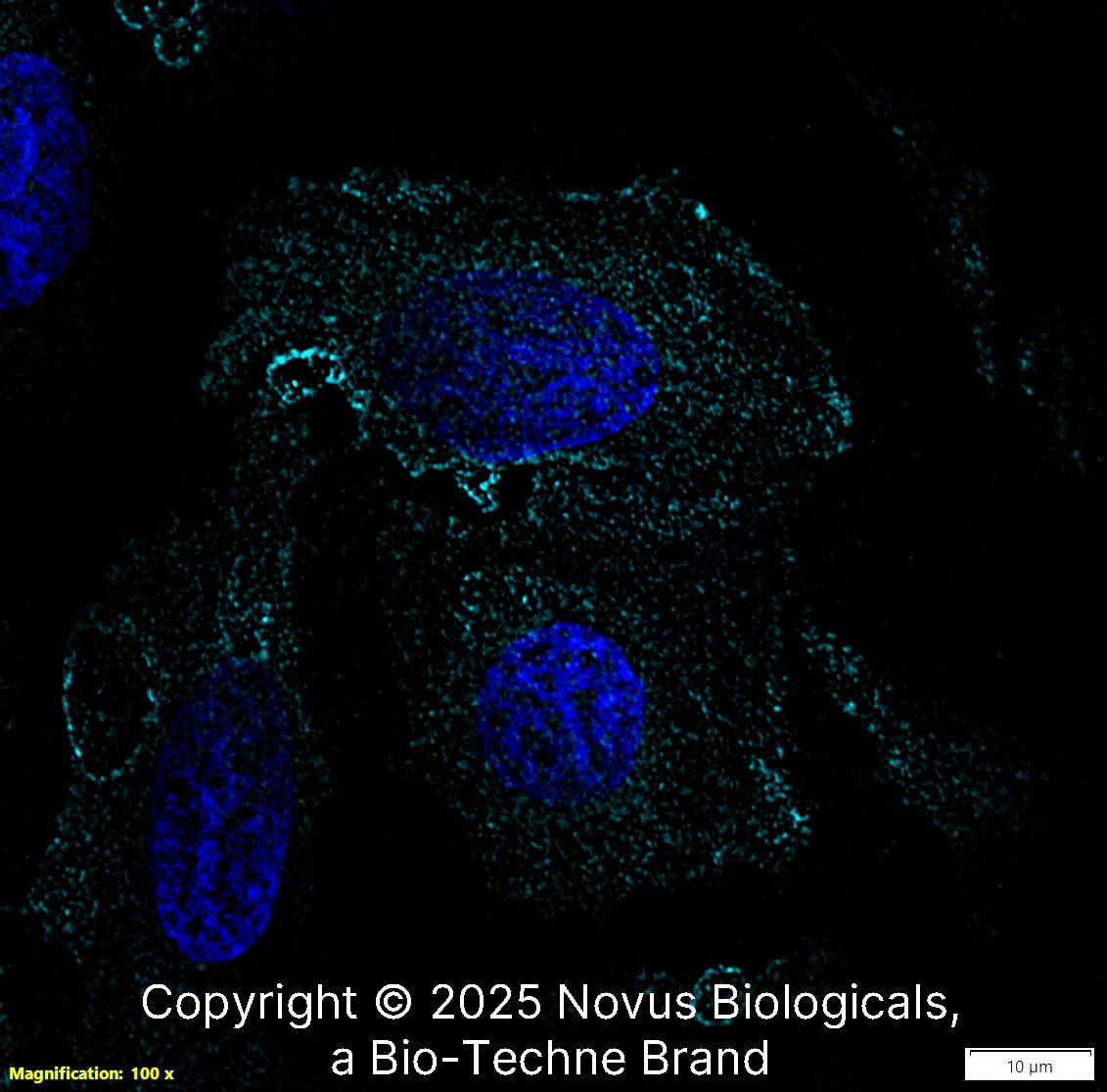 CD34 (QBEnd/10) was detected in immersion fixed U-2 OS human osteosarcoma cell line using Mouse anti-CD34 (QBEnd/10) Protein G Purified Monoclonal Antibody conjugated to Alexa Fluor® 647 (Catalog # NBP2-34713AF647) (light blue) at 10 µg/mL overnight at 4C. Cells were counterstained with DAPI (blue). Cells were imaged using a 100X objective and digitally deconvolved.  