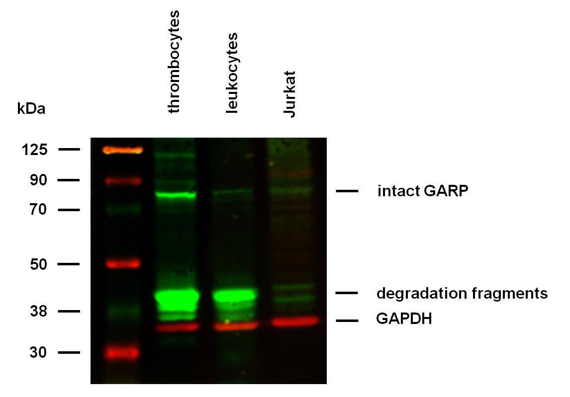 Western Blot: Mouse Monoclonal LRRC32/GARP Antibody (GARP5) [NBP2-37710} - Western blotting analysis was performed on RIPA buffer extracts of thrombocytes, leukocytes, and Jurkat cells mixed with hot reducing SDS-loading buffer. Samples were resolved using 10% SDS-PAGE gel.Nitrocellulose membrane blot was probed with mouse IgG1 monoclonal antibody GARP5 (2 ug/ml), followed by IRDye 800CW Goat-anti-Mouse IgG (green). Mouse anti-GAPDH monoclonal antibody FF26A conjugated with DyLight 680 (0.1 ug/ml), was used as the loading control (red). Multiplex fluorescent Western blot detection was performed.GARP was detected at ~80 kDa in thrombocytes.