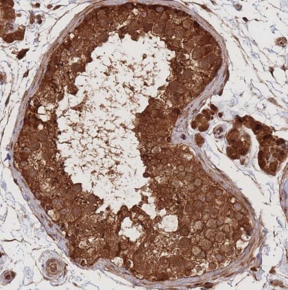 Immunohistochemistry: Endoglycan/PODXL2 Antibody [NBP2-37899] -Staining of human testis shows strong cytoplasmic positivity in cells in seminiferous ducts and leydig cells.