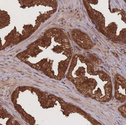 Immunohistochemistry: Endoglycan/PODXL2 Antibody [NBP2-37899] -Staining of human prostate shows strong cytoplasmic positivity in glandular cells.