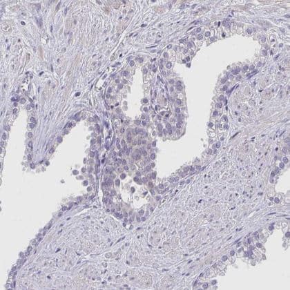 Immunohistochemistry-Paraffin: CRACC/SLAMF7 Antibody [NBP2-37951] -Staining of human prostate shows no positivity in glandular cells as expected.