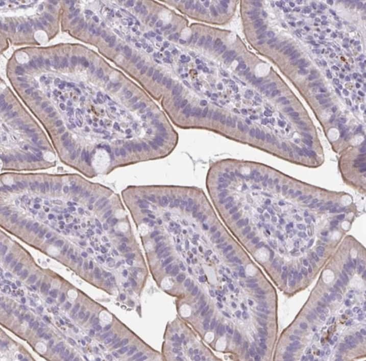 Immunohistochemistry-Paraffin TMEM92 Antibody - BSA Free