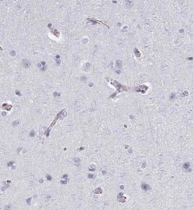 Immunohistochemistry-Paraffin TMEM92 Antibody - BSA Free