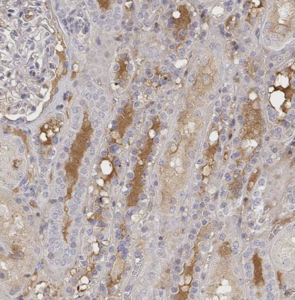 Immunohistochemistry-Paraffin: IGFBP-4 Antibody [NBP2-38086] - Staining of human kidney shows strong positivity in plasma in cells in tubules.