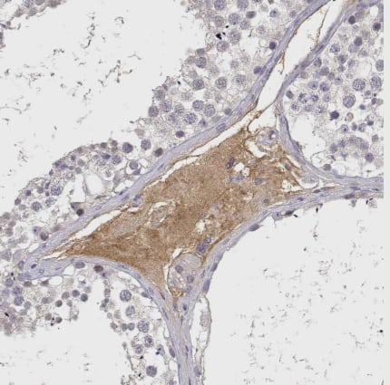 Immunohistochemistry-Paraffin: IGFBP-4 Antibody [NBP2-38086] - Staining of human testis shows strong cytoplasmic positivity in Leydig cells.