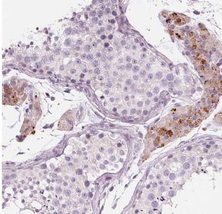 Staining of human testis shows moderate granular pattern in cytoplasmic positivity in Leydig cells.