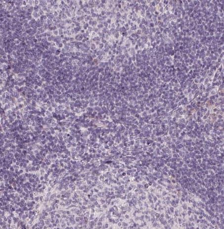 Staining of human tonsil shows no cytoplasmic positivity in non-germinal center cells and germinal center cells as expected.