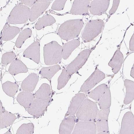 Staining of human skeletal muscle shows negative cytoplasmic positivity in myocytes as expected.