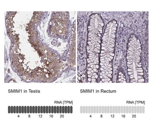 Immunohistochemistry-Paraffin: SMIM1 Antibody [NBP2-38120] - Analysis in human testis and rectum tissues using NBP2-38120 antibody. Corresponding SMIM1 RNA-seq data are presented for the same tissues.