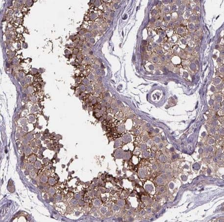 Immunohistochemistry-Paraffin: SMIM1 Antibody [NBP2-38120] -Staining of human testis shows strong membranous positivity in cells in seminiferous ducts.