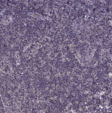 Immunohistochemistry-Paraffin: SMIM1 Antibody [NBP2-38120] -Staining of human tonsil shows no positivity in non-germinal center cells as expected.