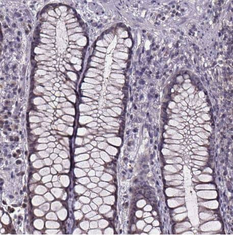 Immunohistochemistry-Paraffin: SMIM1 Antibody [NBP2-38120] -Staining of human rectum shows no positivity in glandular cells as expected.