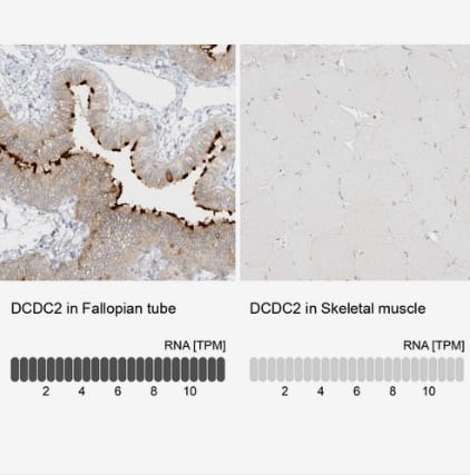 Immunohistochemistry-Paraffin: DCDC2 Antibody [NBP2-38184] -Analysis in human fallopian tube and skeletal muscle tissues using NBP2-38184 antibody. Corresponding DCDC2 RNA-seq data are presented for the same tissues.