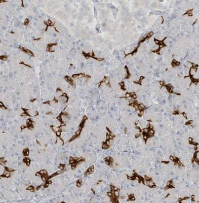 Immunohistochemistry-Paraffin: DCDC2 Antibody [NBP2-38184] -Staining of human pancreas shows strong cytoplasmic positivity in exocrine glandular cells.