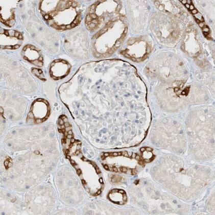 Immunohistochemistry-Paraffin: DCDC2 Antibody [NBP2-38184] -Staining of human kidney shows strong cytoplasmic positivity in Bowman's capsule and cells in distal tubules.