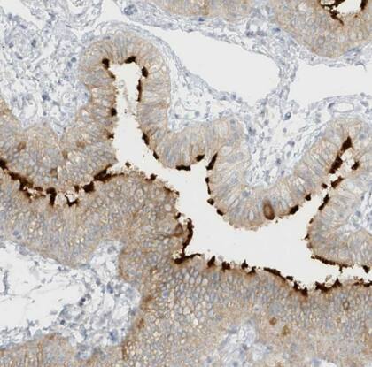 Immunohistochemistry-Paraffin: DCDC2 Antibody [NBP2-38184] -Staining of human fallopian tube shows strong positivity in cilia in glandular cells.