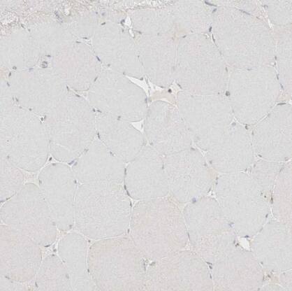 Immunohistochemistry-Paraffin: DCDC2 Antibody [NBP2-38184] -Staining of human skeletal muscle shows no cytoplasmic positivity in myocytes as expected.