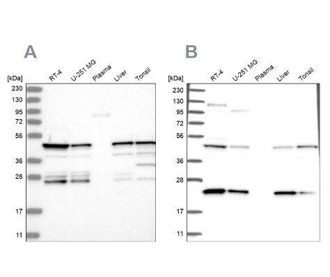 <b>Independent Antibodies Validation. </b>Western Blot: PPP1R7 Antibody [NBP2-38207] - analysis using Anti-PPP1R7 antibody NBP2-38207 (A) shows similar pattern to independent antibody. 