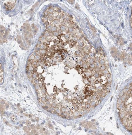 Immunohistochemistry-Paraffin: RPP40 Antibody [NBP2-38260] -  Staining of human testis shows strong cytoplasmic positivity in cells in seminiferous ducts.