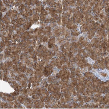 Immunohistochemistry-Paraffin: RPP40 Antibody [NBP2-38260] - Staining of human pancreas shows strong cytoplasmic positivity in exocrine glandular cells.