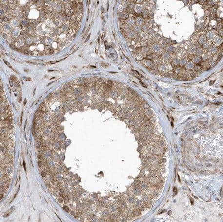 Immunohistochemistry-Paraffin FAM98A Antibody - BSA Free