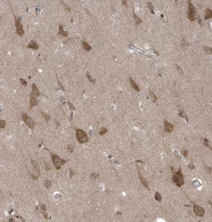 Immunohistochemistry-Paraffin FAM98A Antibody - BSA Free