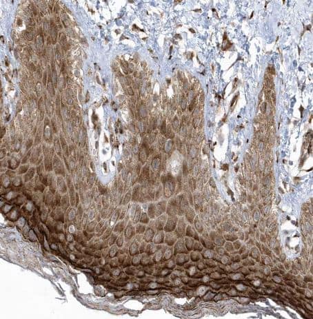 Immunohistochemistry-Paraffin FAM98A Antibody - BSA Free