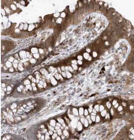 Immunohistochemistry-Paraffin FAM98A Antibody - BSA Free