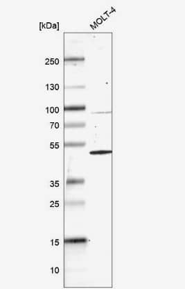 Western Blot: HOMER1 Antibody [NBP2-38309] - Analysis in human cell line MOLT-4.