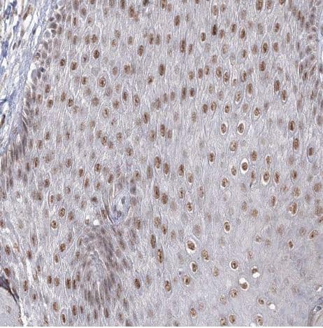 Immunohistochemistry-Paraffin: VGLL4 Antibody [NBP2-38421] -Staining of human skin shows moderate nuclear positivity in squamous epithelial cells. 
