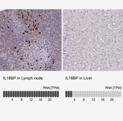 Immunohistochemistry-Paraffin: IL-18 BPa/IL18BP Antibody [NBP2-38481] - analysis in human lymph node and liver tissues using NBP2-38481 antibody. Corresponding IL18BP RNA-seq data are presented for the same tissues.