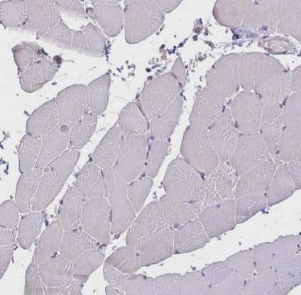 Immunohistochemistry-Paraffin: IL-18 BPa/IL18BP Antibody [NBP2-38481] -Staining of human skeletal muscle shows no positivity in myocytes.