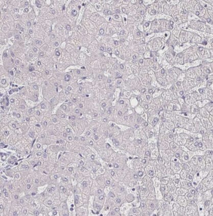Immunohistochemistry-Paraffin: IL-18 BPa/IL18BP Antibody [NBP2-38481] -Staining of human liver shows no cytoplasmic positivity in hepatocytes.