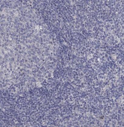 Immunohistochemistry-Paraffin: KCNB1 Antibody [NBP2-38498] -Staining of human tonsil shows no positivity in non-germinal center cells as expected.