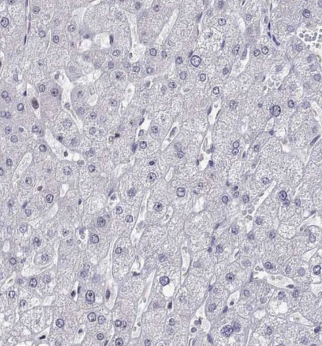 Staining of human liver shows no positivity in hepatocytes as expected.