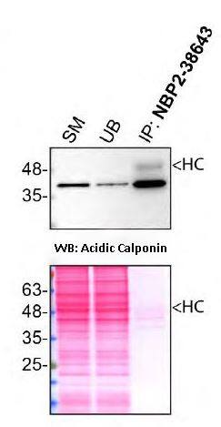 Immunoprecipitation: Acidic Calponin Antibody [NBP2-38643] - HAP1 lysates were prepared, and immunoprecipitation was performed using 2.0 μg of Acidic Calponin Antibody (NBP2-38643) pre-coupled to Dynabeads protein A. Samples were washed and processed for Western Blot with Acidic Calponin Antibody. For Western Blot, Acidic Calponin Antibody was used at 1/1000. The Ponceau stained transfers of each blot are shown. SM=4% starting material; UB=4% unbound fraction; IP=immunoprecipitate; HC=antibody heavy chain. Image, protocol and testing courtesy of YCharOS Inc. (ycharos.com).