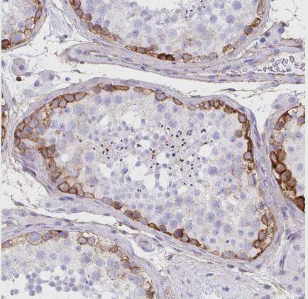 Immunohistochemistry-Paraffin: Drebrin 1 Antibody [NBP2-38650] - Staining of human testis shows strong membranous positivity in spermatogonia.