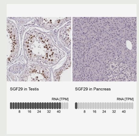 Immunohistochemistry-Paraffin CCDC101 Antibody