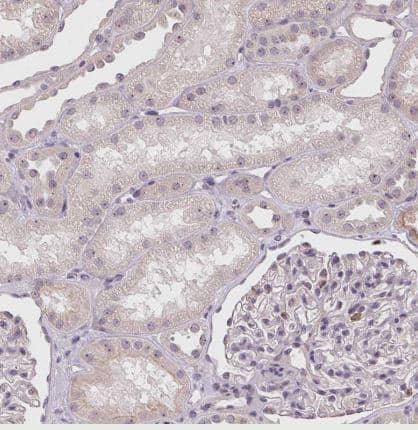 Immunohistochemistry-Paraffin: CCDC101 Antibody [NBP2-38670] -Staining of human Kidney shows very weak nuclear positivity in cells in tubules.