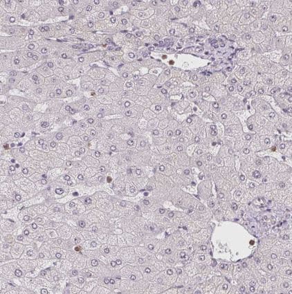 Immunohistochemistry-Paraffin: CCDC101 Antibody [NBP2-38670] -Staining of human Liver shows very weak nuclear positivity in hepatocytes.