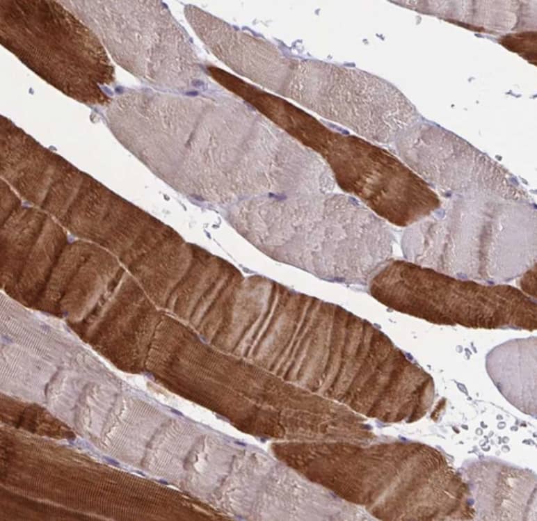 Immunohistochemistry-Paraffin OSBPL7 Antibody - BSA Free