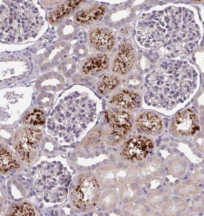 Immunohistochemistry-Paraffin OSBPL7 Antibody - BSA Free