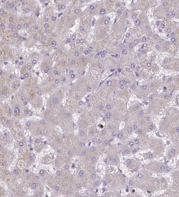Immunohistochemistry-Paraffin OSBPL7 Antibody - BSA Free