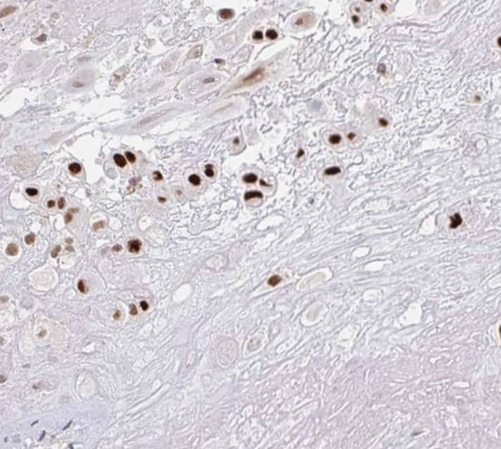 Staining of human placenta shows strong nuclear positivity in decidual cells.
