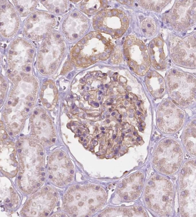 Staining of human kidney shows strong membranous positivity in cells in glomeruli.