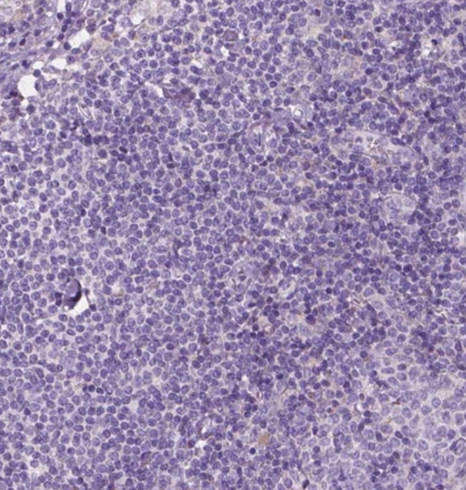 Staining of human lymph node shows no positivity in non-germinal center cells as expected.