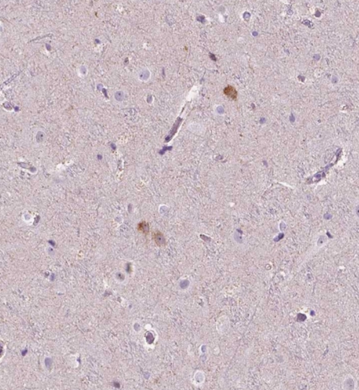  Staining of human cerebral cortex shows moderate cytoplasmic positivity in a subset of neurons.