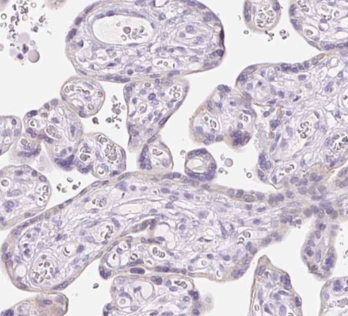 Staining of human placenta shows no positivity in trophoblastic cells as expected.