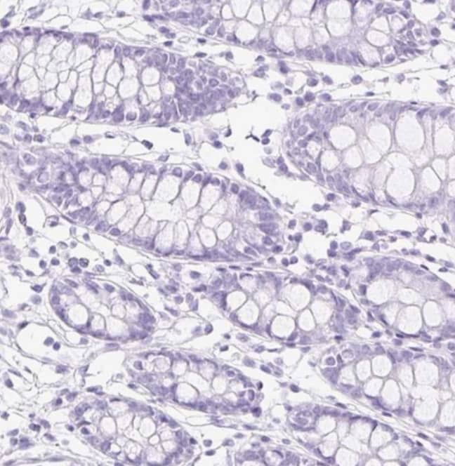 Staining of human colon shows no positivity in glandular cells as expected.